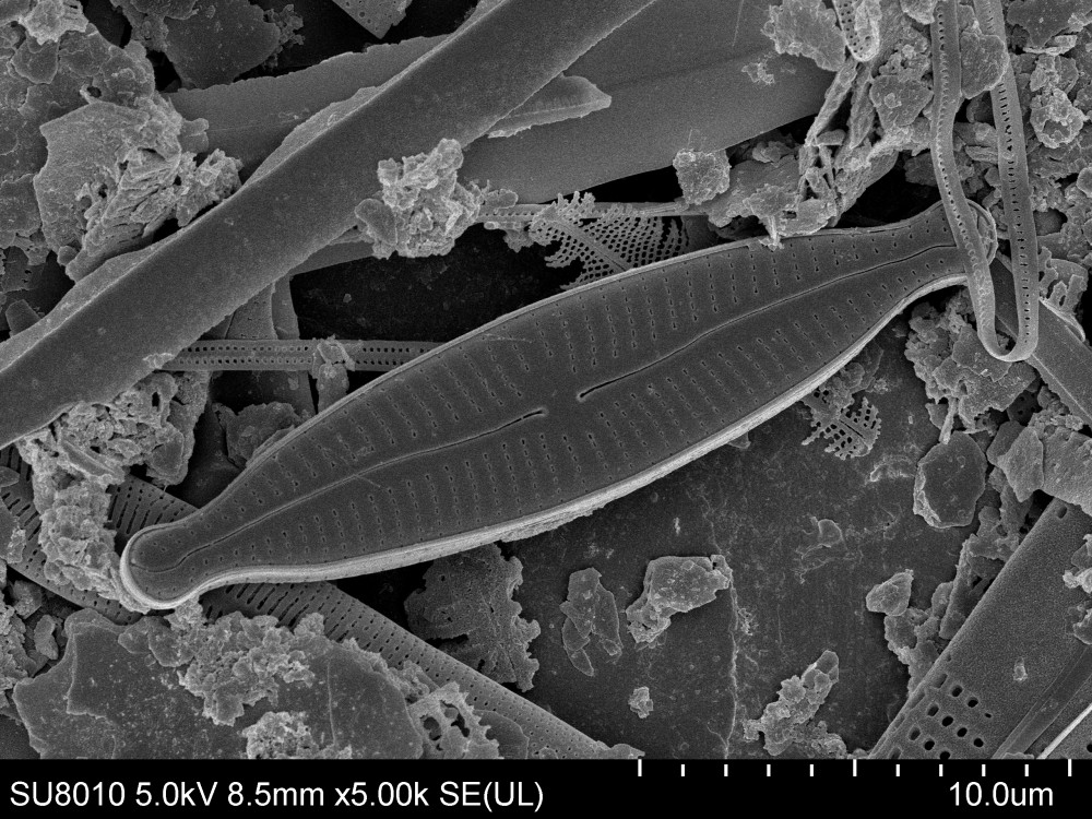 Encyonopsis Krammer